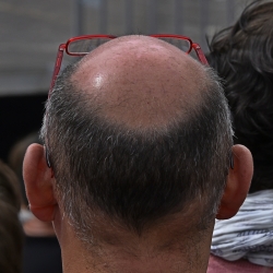 Vue arrière.
